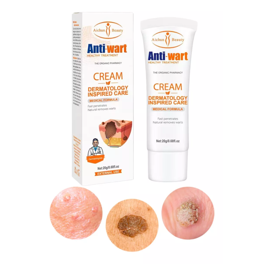 Crema Antiverrugas Aichun Beauty – 20g | Elimina Verrugas Sin Dolor ni Cicatrices